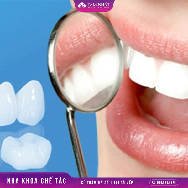 Bọc răng sứ là một phương pháp mà có thể giúp chúng ta khắc phục được tình trạng như răng bị nứt vỡ