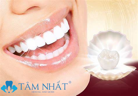 Khi bọc răng sứ titan sẽ giúp bạn được tự tin và thoải mái hơn