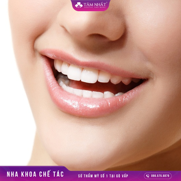 Răng sứ có độ bền cao hơn gấp 5 lần so với răng thật