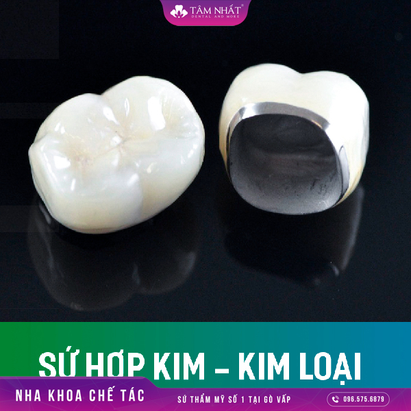 viền của răng sứ kim loại sẽ bị lộ ra và gây nên tình trạng chân răng sứ bị đen