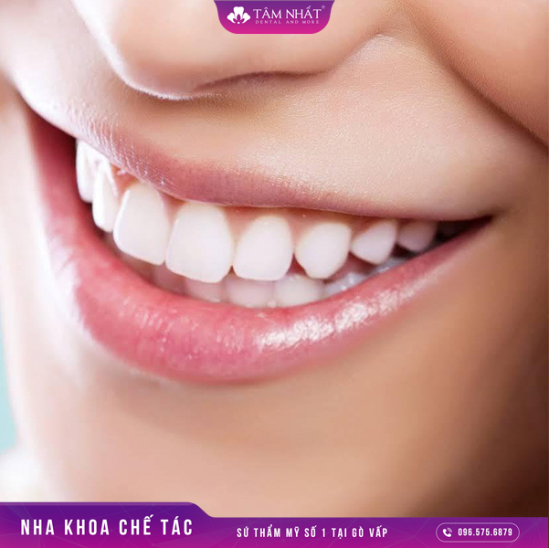 Ttuổi thọ của răng sứ dài hay ngắn thì còn sẽ phụ thuộc vào nhiều yếu tố