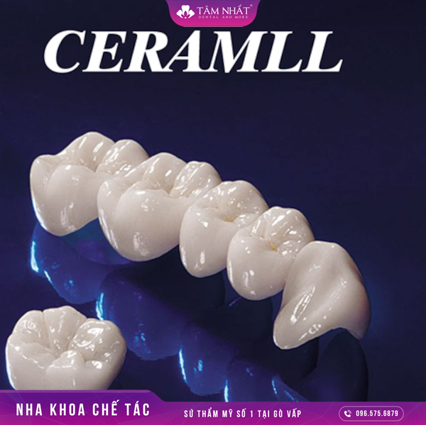 Răng sứ Ceramill chính là loại răng giả mà thuộc dòng răng sứ cao cấp