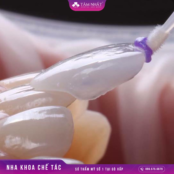 Dán sứ răng chính là một trong những phương pháp có thể phục hình được tính thẩm mỹ cho răng
